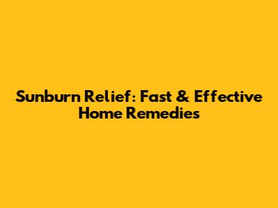 Sunburn Relief: Fast & Effective Home Remedies